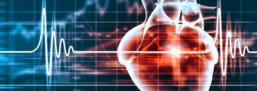 La chirurgie cardiaque par incision axillaire (sous le bras) : Une approche alternative de la chirurgie cardiaque